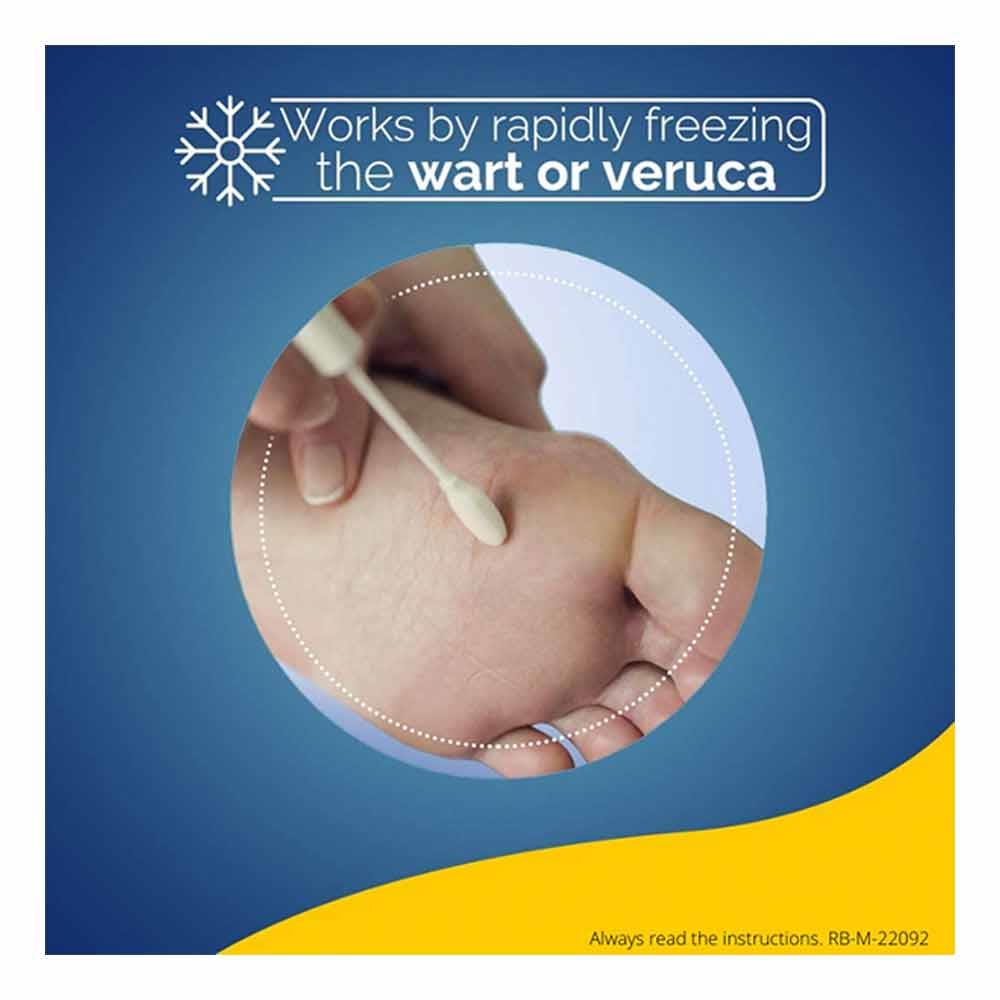 Scholl Freeze Verruca & Wart Remover 80ml