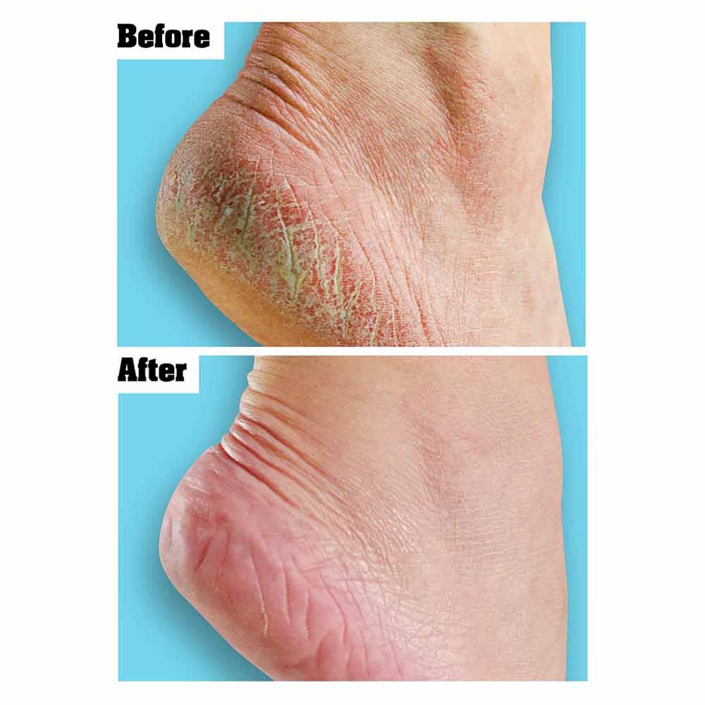 O'Keeffe's For Healthy Feet Foot Cream 91g