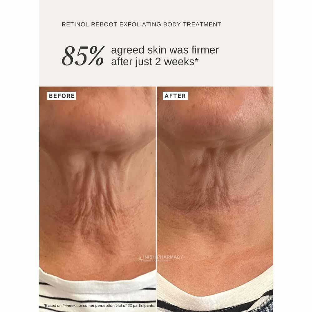 Alpha-H Retinol Reboot Body Treatment 120ml