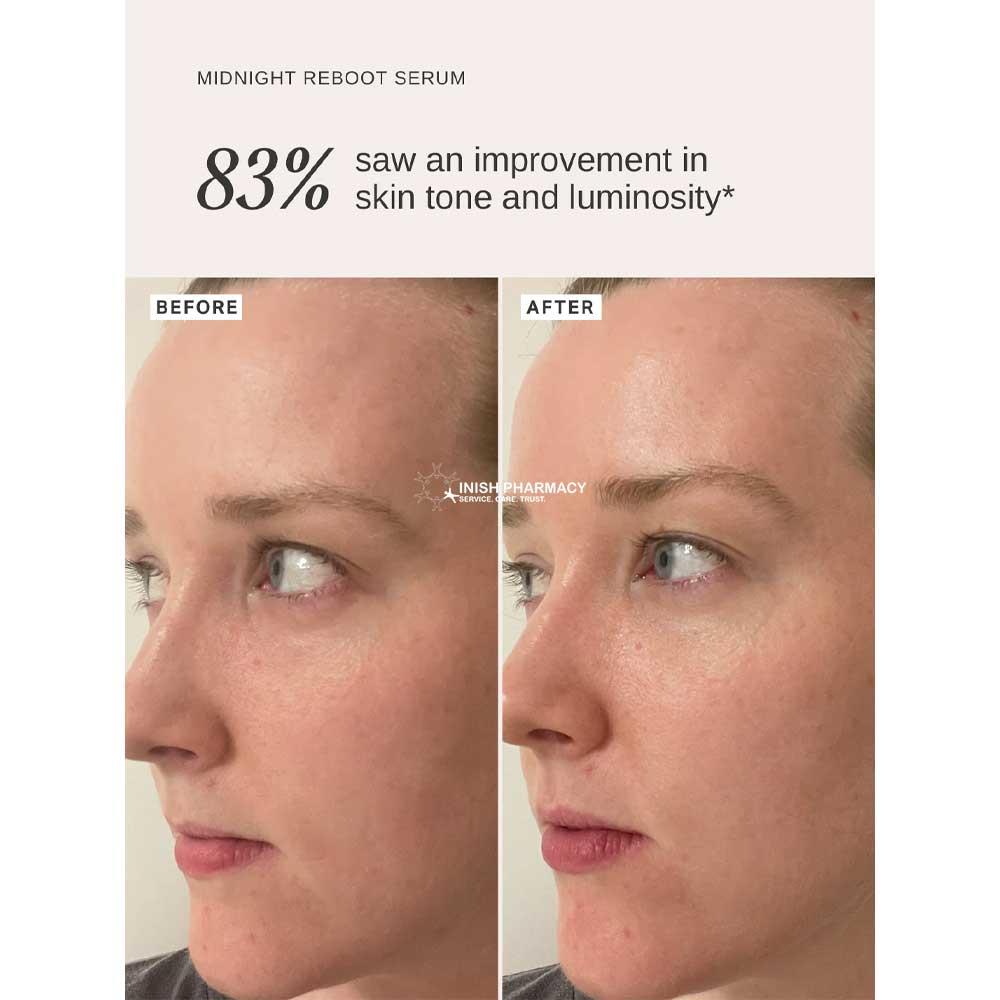 Alpha-H Midnight Reboot Serum With 14% Glycolic Acid + Granactive Retinoid 10ml