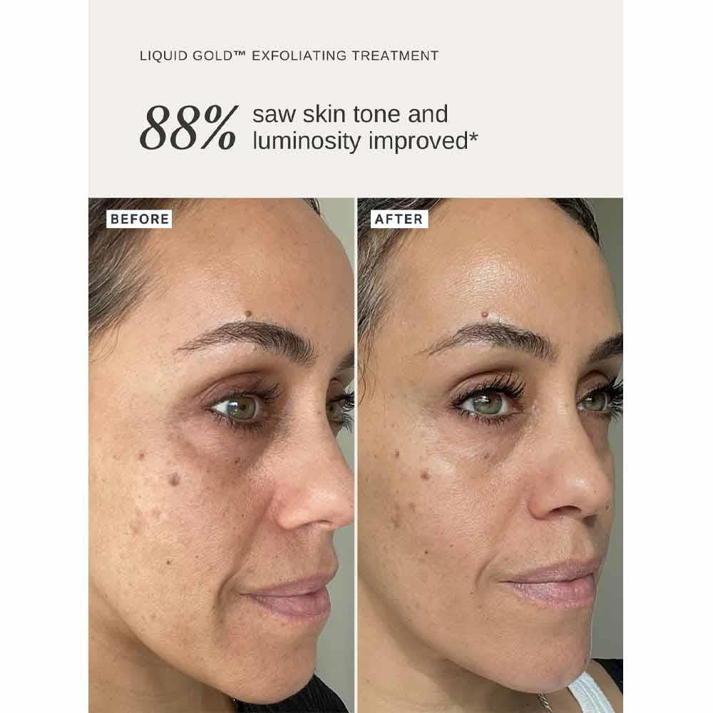 Alpha-H Liquid Gold Trial Kit