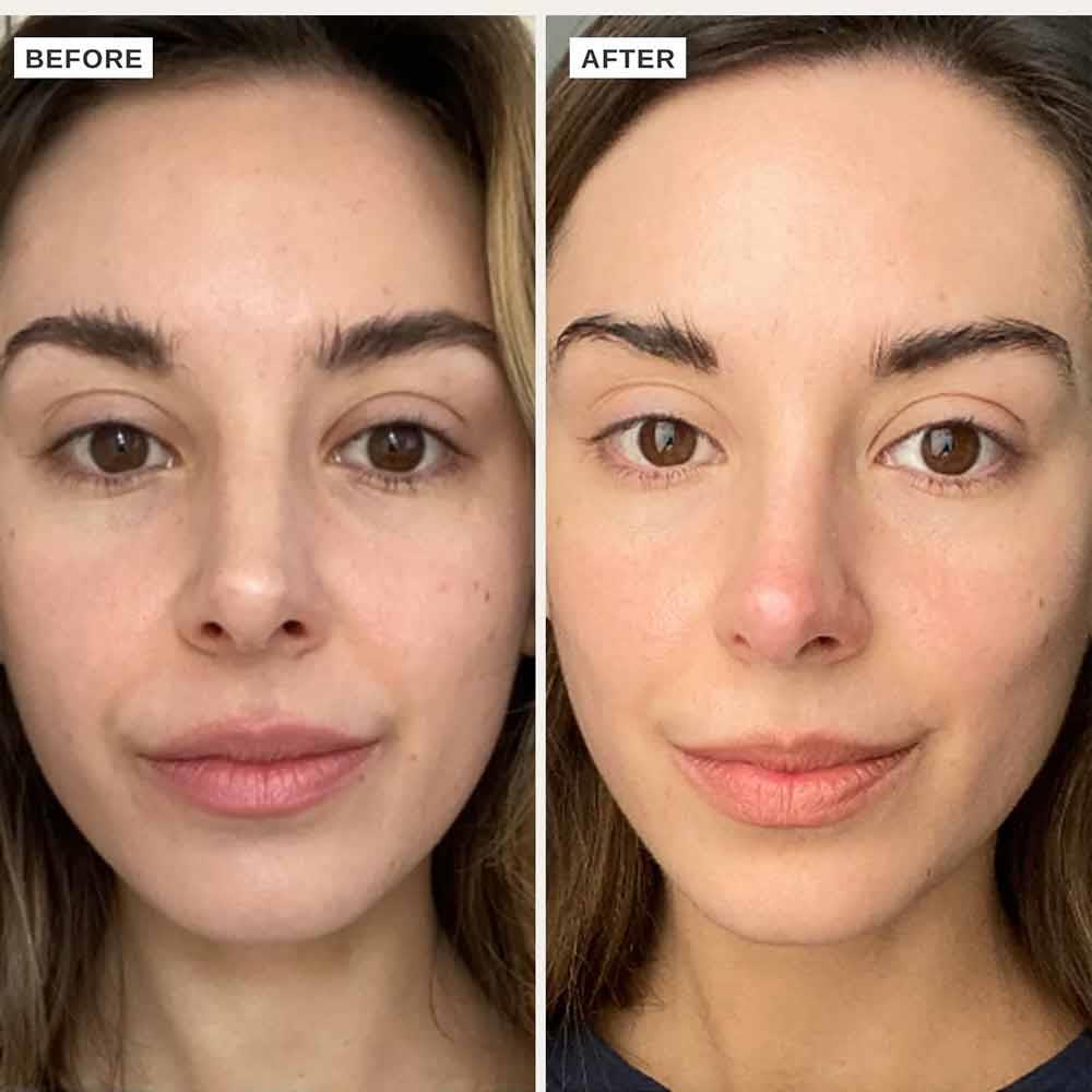 Alpha-H Vitamin C Serum With 10% Ethyl Ascorbic Acid 25ml