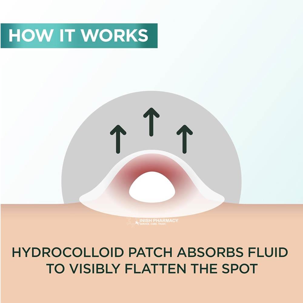 Garnier Pure Active Pimple Patch 22 Pack