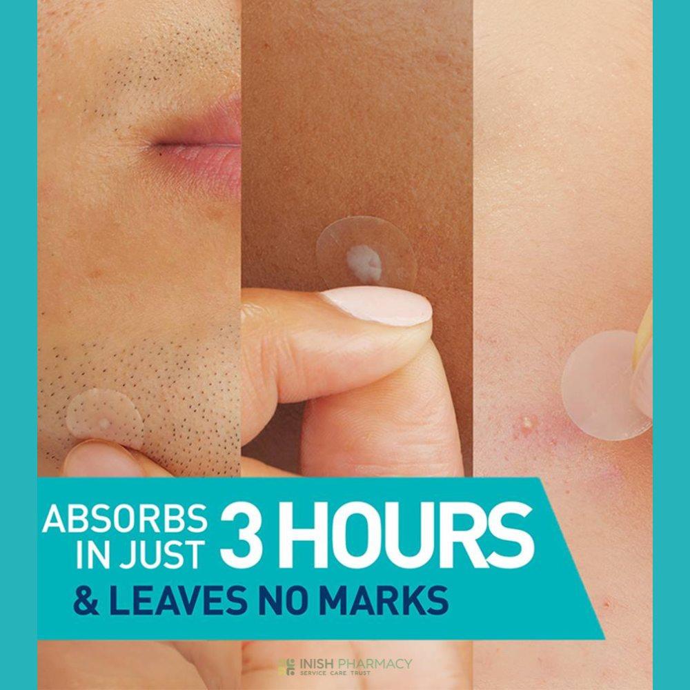 CeraVe Blemish Barrier Patches 22 Pack