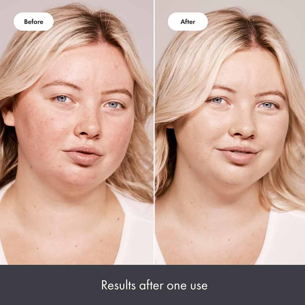 Hero Rescue Blam Plus Red Correct 15ml