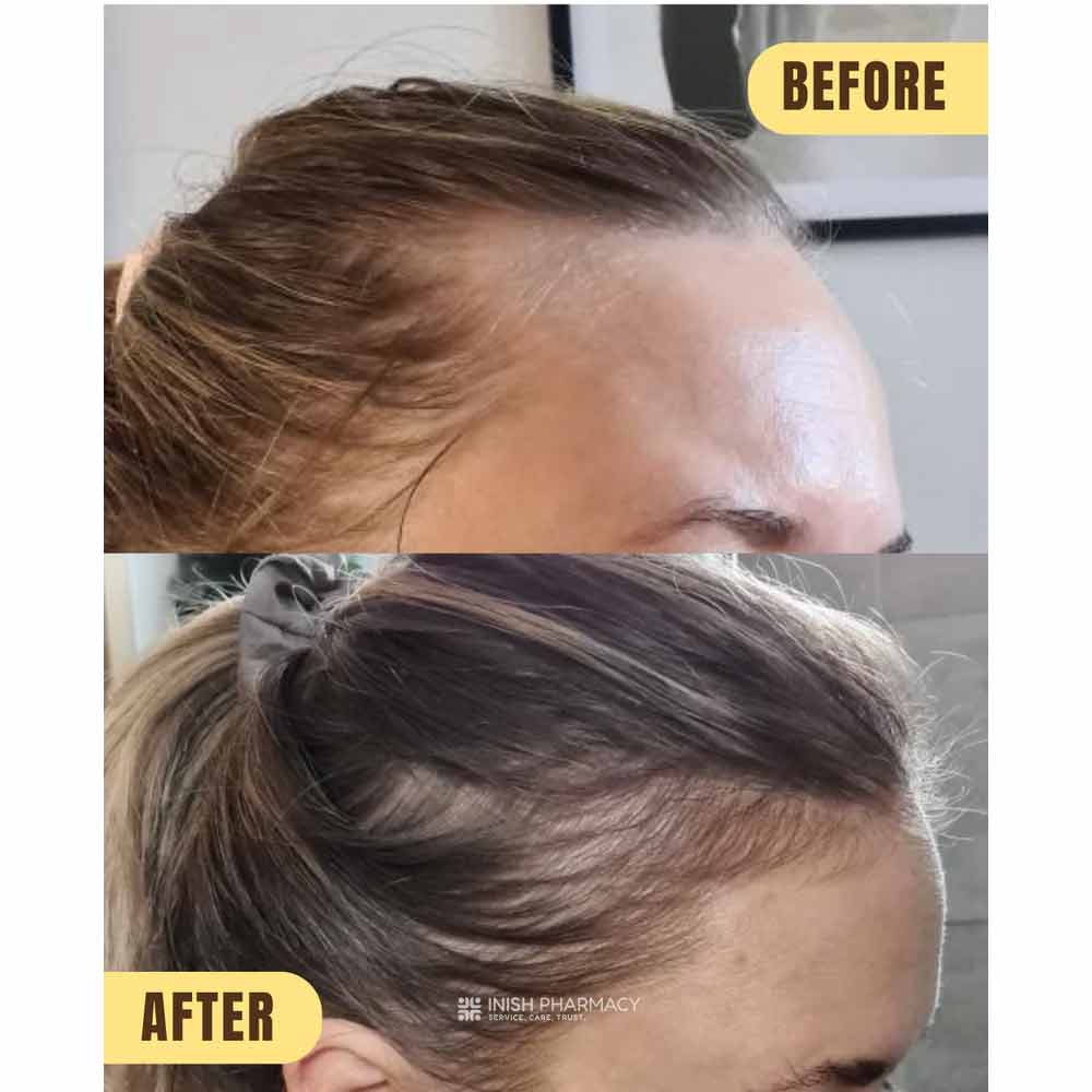 Hair Syrup Pre-Wash Oil Growsmary 100ml