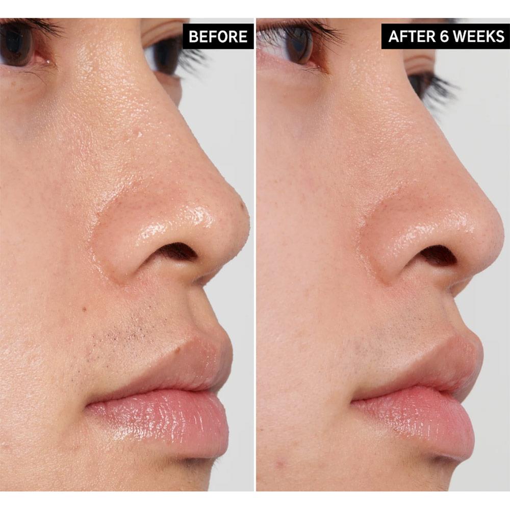 The Inkey List PHA Toner 100ml