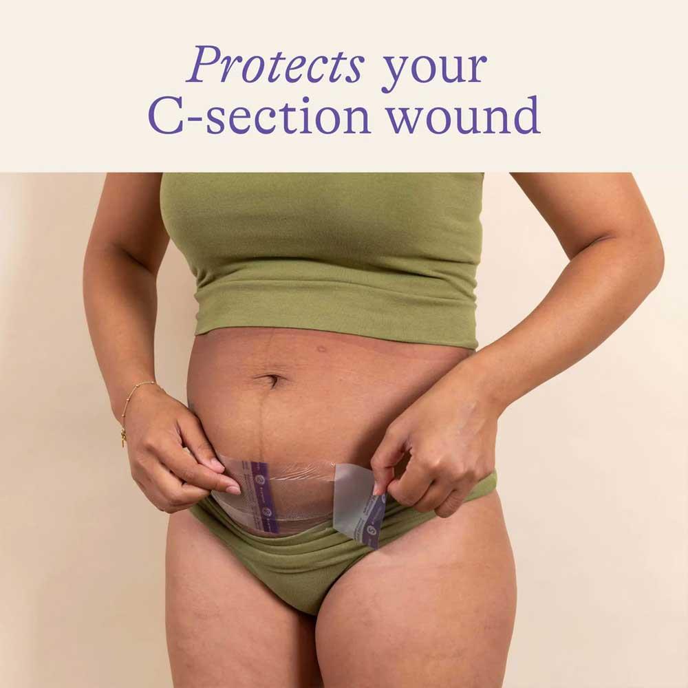 Lansinoh C-Section Hydrogel Pads 2 Pack