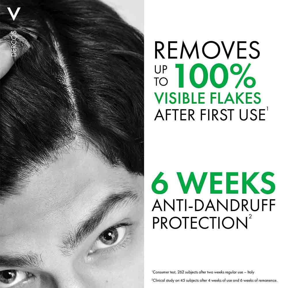 Vichy Dercos Anti Dandruff & Itchy Scalp Shampoo Normal to Oily Hair 390ml