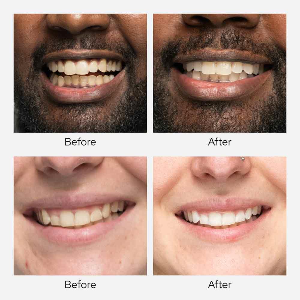 Spotlight Oral Care Teeth Whitening Powder With Diamond PAP+