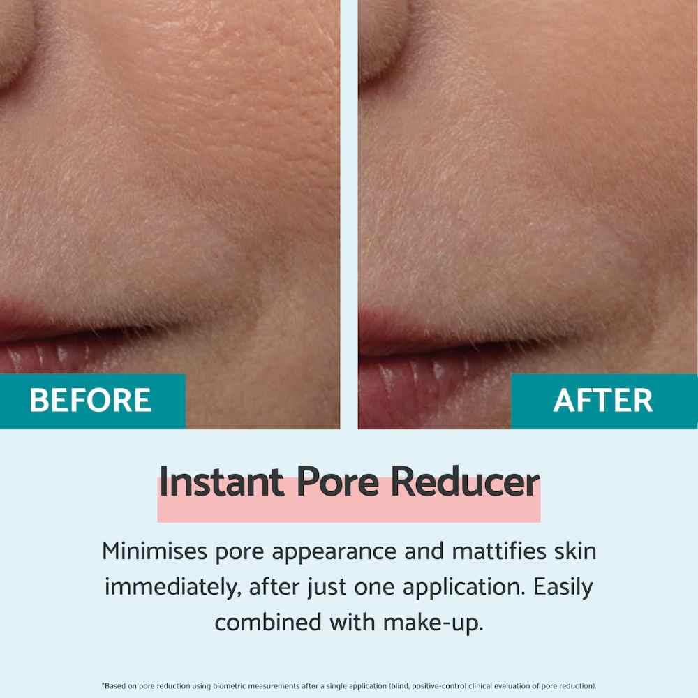 Remescar Instant Pore Reducer 20ml