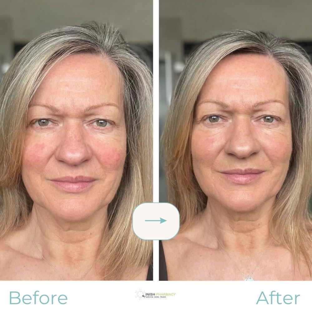 Rosalique 3-in-1 Anti-Redness Miracle Formula SPF50