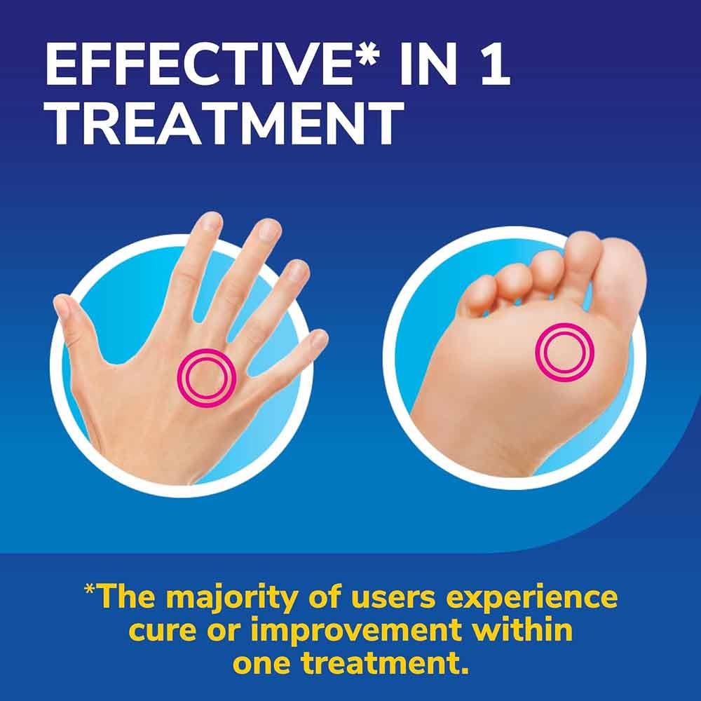 Scholl Freeze Away MAX Verruca & Wart Remover