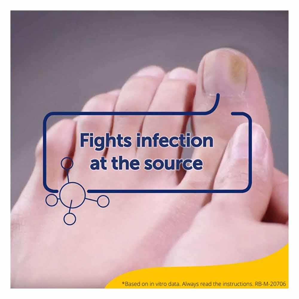 Scholl Fungal Nail Complete Treatment Kit