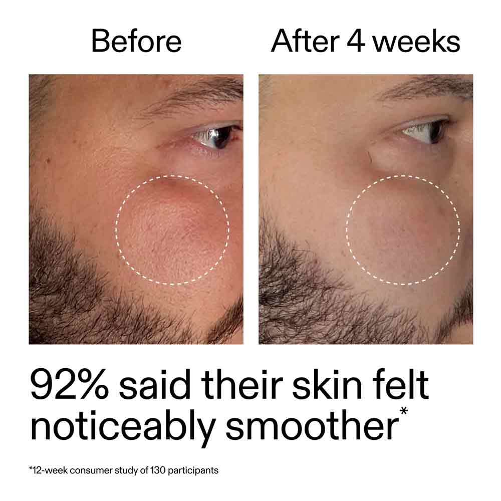 The Inkey List Starter Retionol Serum 30ml