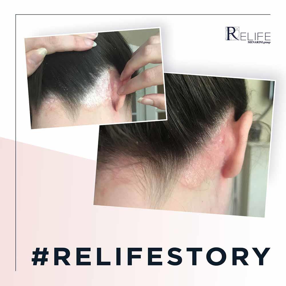 Relife U-Life 10 Ecofoam 100ml