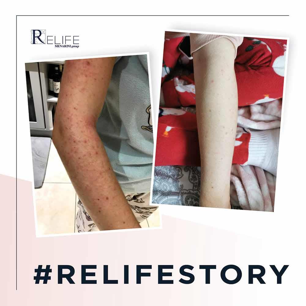 Relife Relizema Cream 100ml