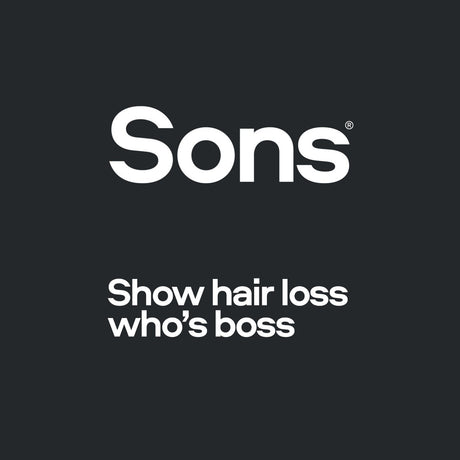 sons hair loss ireland