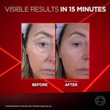 L'Oreal Paris Revitalift Laser Eye Bag Instant Eraser 15ml