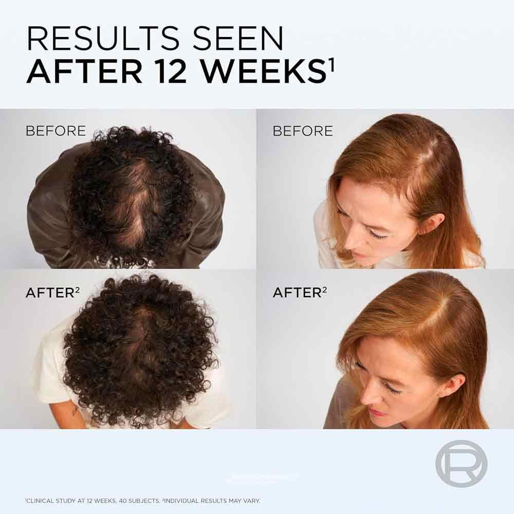 L'Oreal Elvive Hair Growth Booster Serum