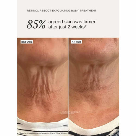 Alpha-H Retinol Reboot Body Treatment 120ml