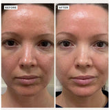 Alpha-H Vitamin B Serum With 0.5% Niacinamide 10ml