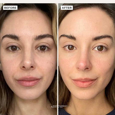 Alpha-H Vitamin C Serum With 10% Ethyl Ascorbic Acid 10ml
