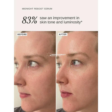 Alpha-H Midnight Reboot Serum 50ml