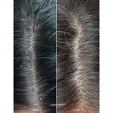 Alpha-H Healthy Scalp Treatment 100ml