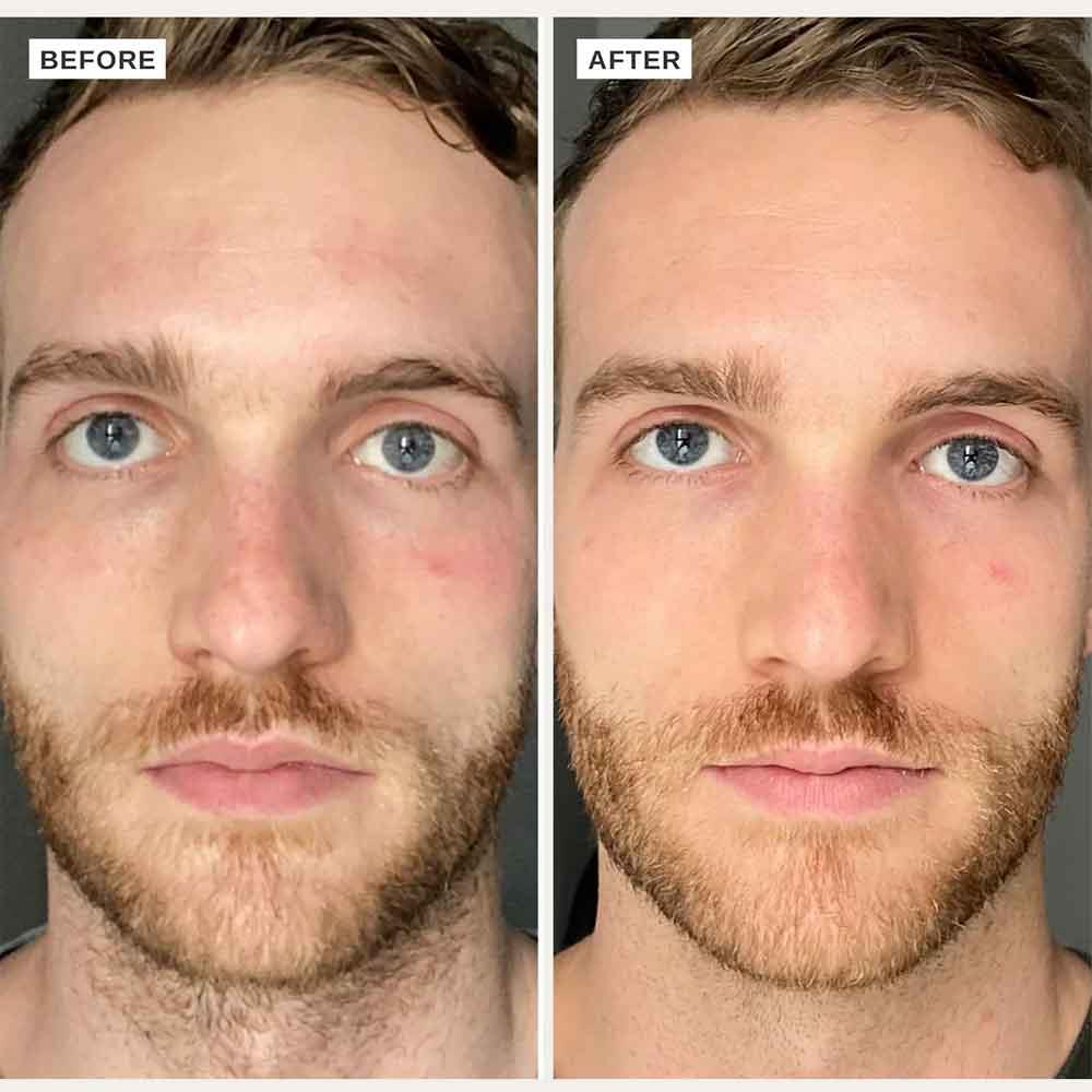 Alpha-H Vitamin B Serum With 5% Niacinmide 25ml