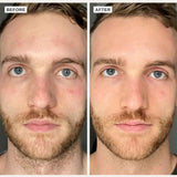 Alpha-H Vitamin B Serum With 5% Niacinmide 25ml