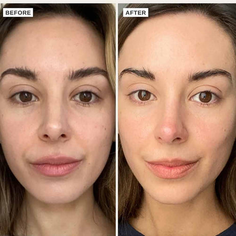 Alpha-H Vitamin C Serum With 10% Ethyl Ascorbic Acid 25ml