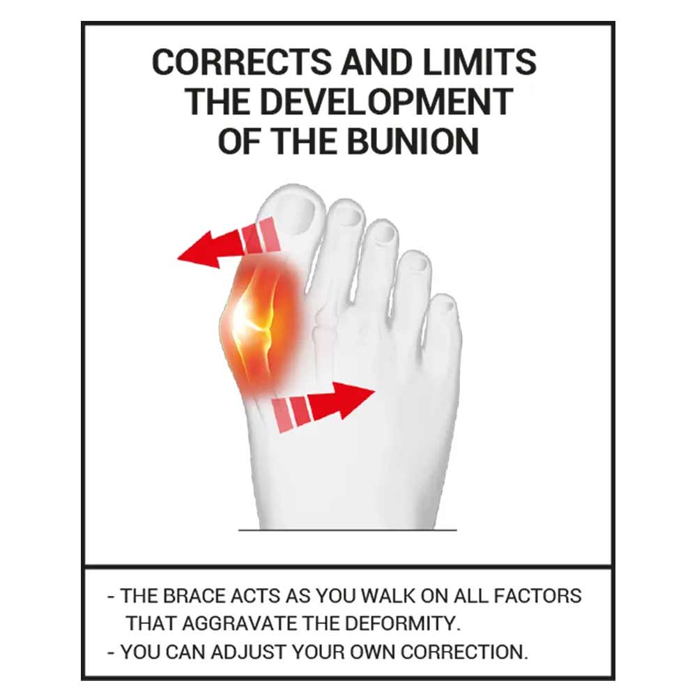 Epitact Flexible Bunion Corrector
