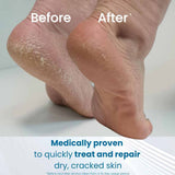 Flexitol Cracked Heel Balm 25% Urea With Vitamin B5 + Shea Butter 112g