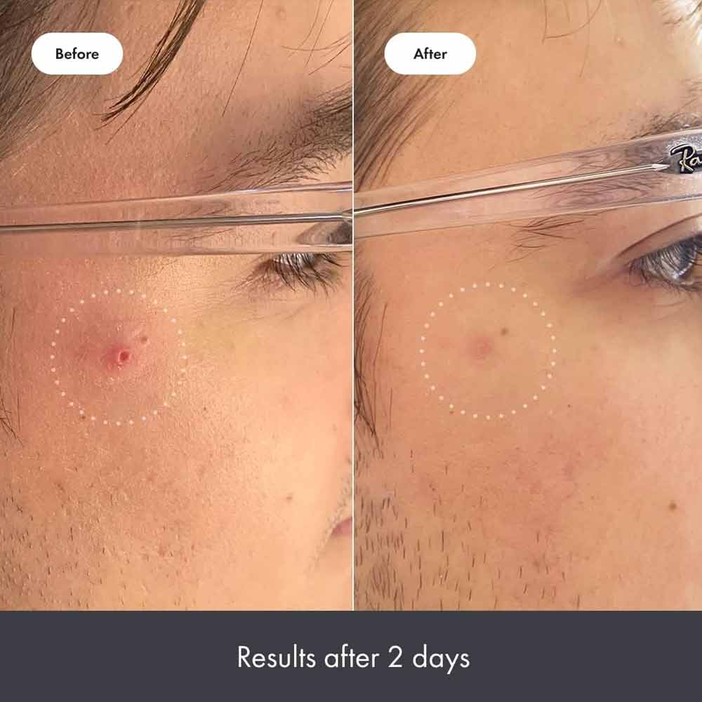 Hero Rescue Balm 15ml