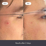 Hero Rescue Balm 15ml