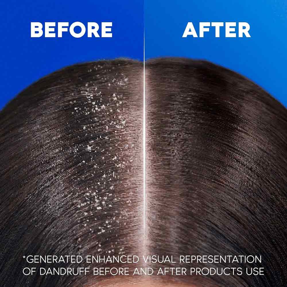 Head & Shoulders Classic Clean 2-in-1 Shampoo & Conditioner 1000ml