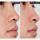 The Inkey List PHA Toner 100ml