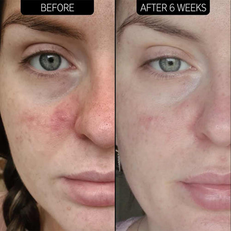The Inkey List Super Solutions Redness Relief 10% Azelaic Acid Serum 30ml