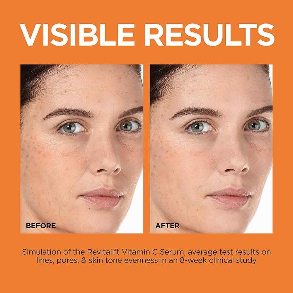L’Oreal Revitalift Clinical 12% Pure Vitamin C Serum 30ml