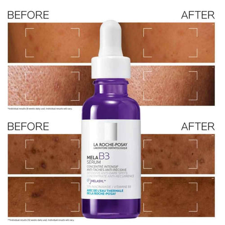 La Roche Posay Correct & Protect Bundle - Mela B3 Serum + Anthelios Age Correct SPF50