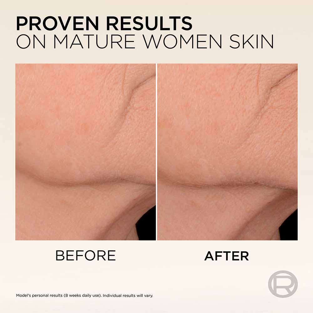 L'Oreal Age Perfect Micro Collagen Serum 30ml