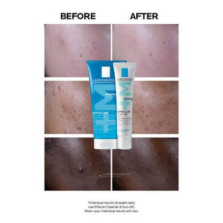 La Roche Posay Effaclar Duo+ M Moisturiser 15ml