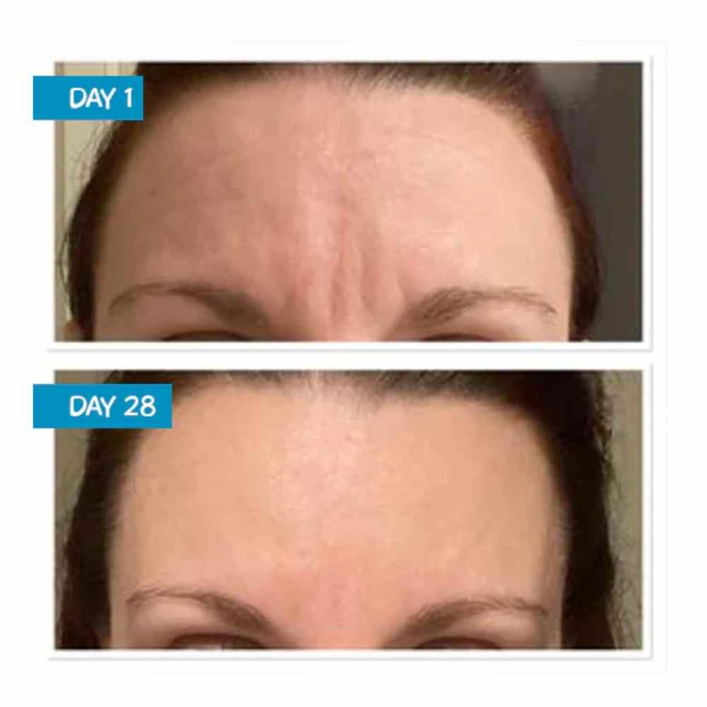 Moogoo Amplified Anti-Ageing Peptide Active Serum 25ml