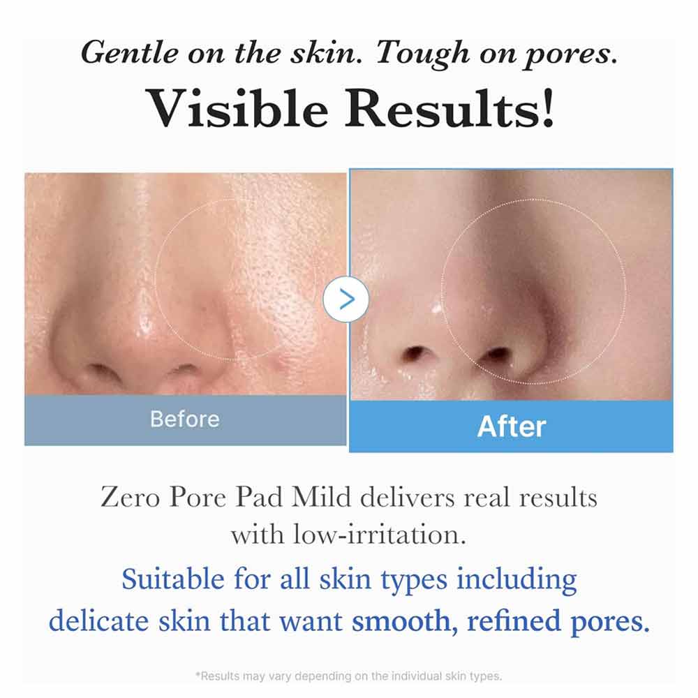 Medicube Zero Pore Pad Mild 155g