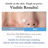 Medicube Zero Pore Pad Mild 155g