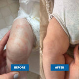 Moogoo Pink Eczema Cream Barrier Support 120g