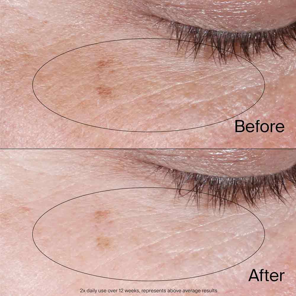 Neutrogena Collagen Bank Reviving Eye Gel Cream 15g
