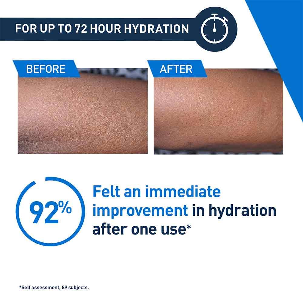 CeraVe Intensive Moisturising Lotion For Very Dry Itchy Skin