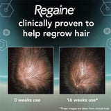 Regaine For Men Extra Strength Foam 5% Minoxidil 3 Month Supply 3x60g